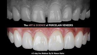 Porcelain Veneers Master Class in New Delhi India