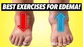 Top 7 Exercises for Leg Edema or Swelling (Program or Protocol for Edema)