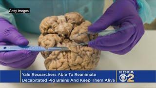 Scientists Bring A Severed Brain Back To Life, Sparking Ethical Debate