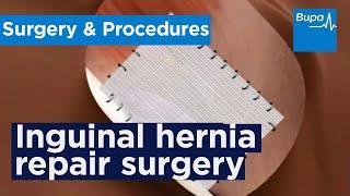 How open inguinal hernia repair surgery is carried out | Bupa Health