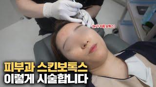 Skin Botox Demonstration: Effective Areas and Safe Practices