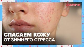 Спасаем КОЖУ от ЗИМНЕГО СТРЕССА! ТЕМЫ НЕДЕЛИ | Доктор 24