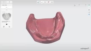 3Shape Dental System - Full Denture - Scanning