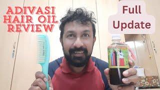 Adivasi Hair oil honest review | Adivasi Sudesh Herbal Hair Oil | Adivasi Hair Oil Review