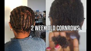 Taking out my 2 WEEKS OLD CORNROWS after using a Conditioner  (ALOPECIA VERSION) And THIS HAPPENED!!