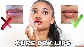 How to fix your dry lips!