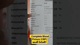 Complete Blood Picture (CBP) అంటే ఏమిటి ? Dr Sai Chandra