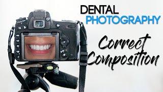 Dental Photography Basics - How to Take a Quality Dental Photo - Correct Composition