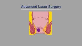 Benefits of Laser Piles Treatment | Safe & Painless Treatment | Pristyn Care