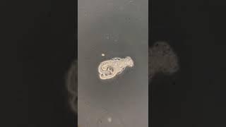 Amoeba eating its food