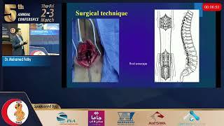 Day2 Session 3.3 Growth friendly techniques in early onset scolosis - Mohamed Fathy 3/3/2023