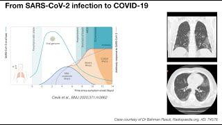 SCOG Virtual Lecture Series - Emanuel Wyler (BIMSB/MDC, Berlin)