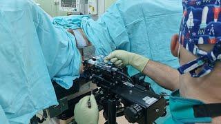 Рак простаты. Брахитерапия в клинике урологии Сеченовского Университета