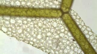 Hydrodictyon, a net-like green alga