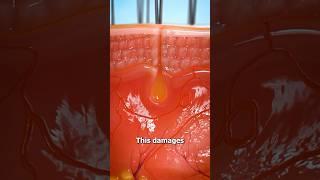 Why You Shouldn’t Pluck Hairs  Surgeon Reacts