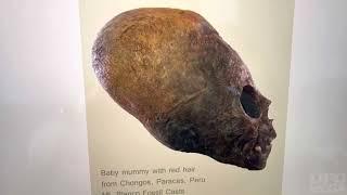 Elongated skull DNA