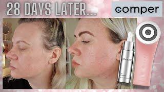 COMPER SMARKIN EMS, LED, RF, MASS Before & After Results After 28 Days Use! | Clare Walch