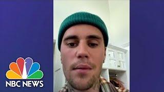 Justin Bieber Says He Has Ramsay Hunt Syndrome