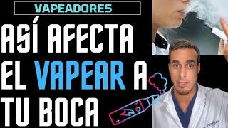 VAPEADORES o CIGARRILLOS ELECTRÓNICOS - Efectos de VAPEAR en tu BOCA