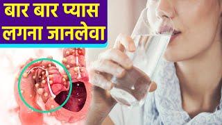 बार बार प्यास लगना Bowel Cancer Symptoms, जाने क्या है कारण Watch Video |Boldsky