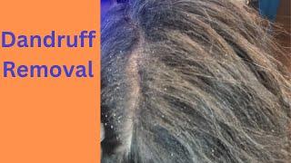 Dandruff Removal - light but thorough scratch