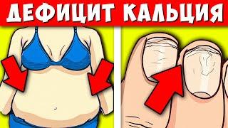 9 Тревожных Сигналов Дефицита Кальция в организме! Вот, чем Восполнить недостаток Кальция