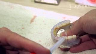 Positioning of the Teeth - JUVORA Dental Disc