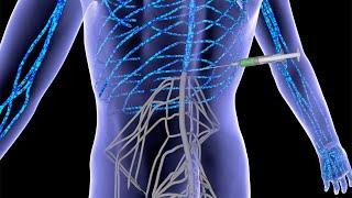Severe spinal cord injuries repaired with 'dancing molecules'