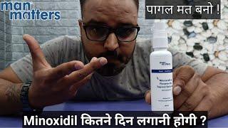 Minoxidil for hair regrowth. कितने दिन लगानी होगी ?पागल मत बनो !