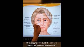 Aging Face Signs: Upper Face Area | Assoc. Dr. Erdem Guven