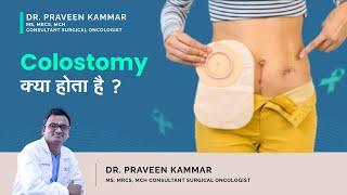 Colostomy क्या होता है ? |  Colostomy in Hindi | Colostomy kyu ki jati hai | Dr Praveen Kammar