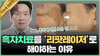 리팟레이저로 단.번.에. 흑자 제거가 가능하다? 솔직하게 말씀드립니다