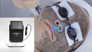 Black Doll Facial Treatment | How to use Pico Laser Tattoo Removal Machine | Operation Demo