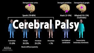 Cerebral Palsy, Animation