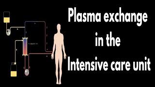 Plasma exchange in the intensive care unit