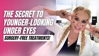 Here's What ACTUALLY Works for Under-Eyes - NON SURGICAL TREATMENTS