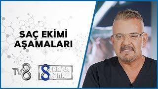 Saç Ekimi Aşamaları | Dr. Koray Erdoğan | 8'de Sağlık