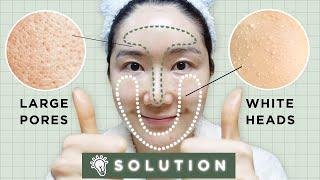 Remove Whiteheads & Unclog Tighten Large Pores w Patent Ingredients(Proven by clinical tests)