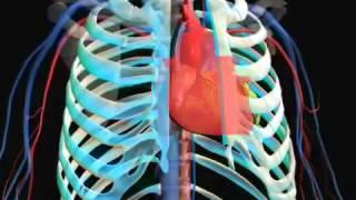 Кардиохирургия   Аорто коронарное шунтирование   coronary artery bypass