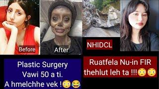 Ruatfela Nu-in FIR thehlut leh ta !Plastic Surgery Vawi 50 a ti! A hmelchhe vek ..