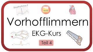 Vorhofflimmern sicher erkennen – EKG auswerten leicht gemacht  (Tachyarrhythmia absoluta, EKG-Kurs)