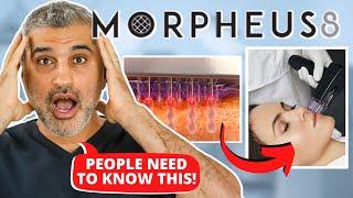 Plastic Surgeon Reveals the REAL TRUTH about Morpheus 8