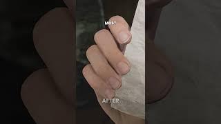 The most DISGUSTING and GREAT detail in the game  | SILENT HILL 2