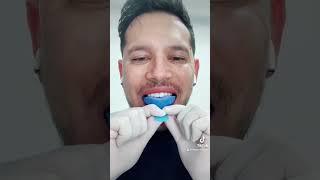 HACER UNA DENTADURA DESDE TU CASA ?  #viral