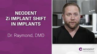 Neodent Zi Implant Shift in Implants | Dr. Raymond