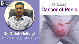 CANCER OF PENIS. Causes, Symptoms, Diagnosis & Treatment - Dr. Girish Nelivigi | Doctors' Circle