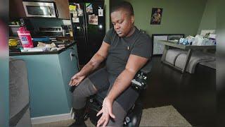 Denver police recruit who lost both legs files lawsuit