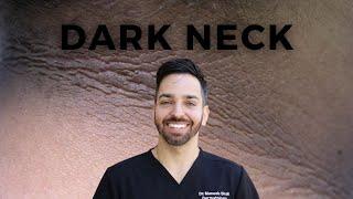 Dark Neck? Acanthosis Nigricans #shorts