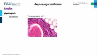 Pathologie ─ Anpassungsreaktionen