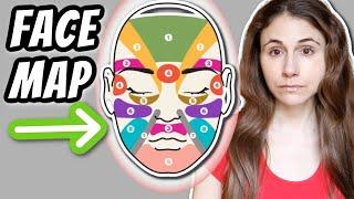 What can FACE MAPPING YOUR ACNE tell you? | Dr Dray